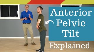 What is Anterior Pelvic Tilt Posture [upl. by Swarts]