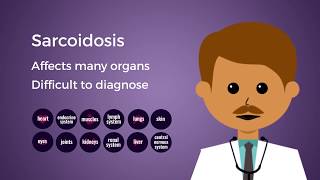 CHEST Foundation Sarcoidosis – What are the Symptoms [upl. by Aidua242]