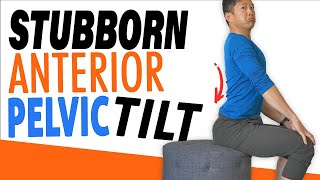 The Simple Fix for Anterior Pelvic Tilt [upl. by Ronen555]