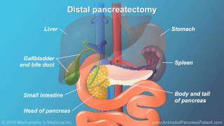 Pancreatic Surgery Benefits Risks and Relevant Anatomy [upl. by Rico]