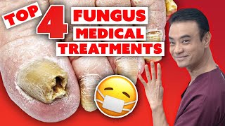 4 MEDICAL treatments to get rid of toenail fungus  Holistic Toenail Fungus Cures Part 3  Dr Kim [upl. by Anitahs729]