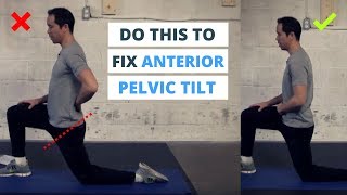 6 Minute Routine to Correct ANTERIOR Pelvic Tilt [upl. by Benedetta]