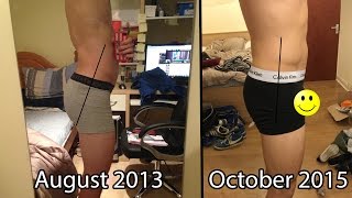 How to Fix APT Anterior Pelvic Tilt  EatLiftGain [upl. by Liberati]