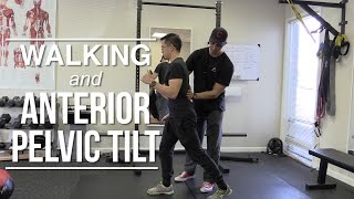 Walking and anterior pelvic tilt [upl. by Nnor]