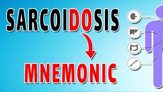 Sarcoidosis–What are my Treatment Options [upl. by Kenn]