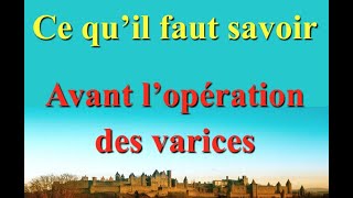 Chirurgie des varices  ce qu’il faut savoir avant l’opération [upl. by Arihas438]