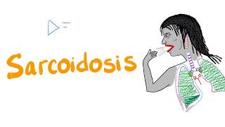 Sarcoidosis  a Mystery Disease [upl. by Kiyoshi382]