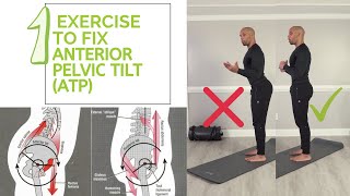 1 Exercise to Fix Anterior Pelvic Tilt APT [upl. by Cissej]